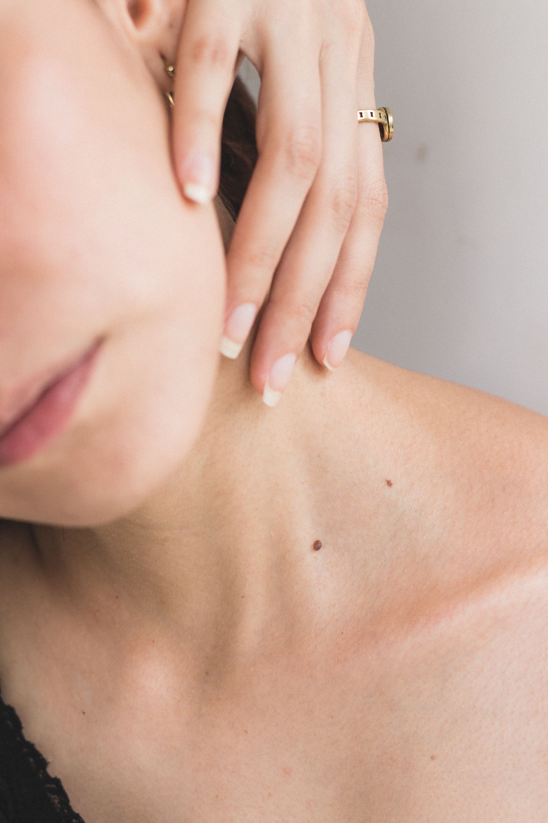 skin cancer